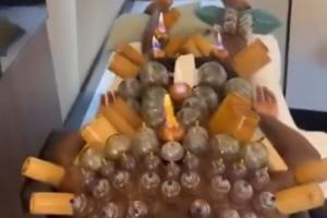 神秘一幕！30岁奥纳纳拔罐恢复，肩部至小腿布满罐印